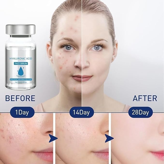 Youthelle™ Moisturizing Essence