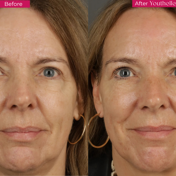 Youthelle™ Moisturizing Essence