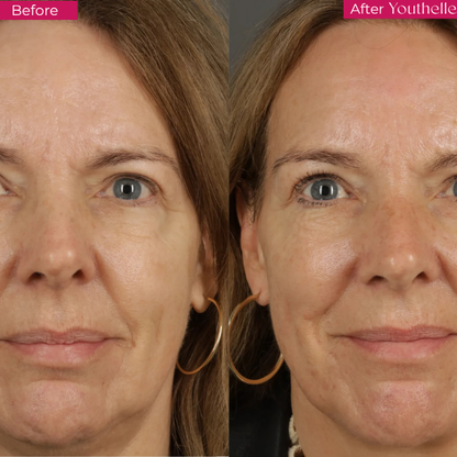 Youthelle™ Moisturizing Essence