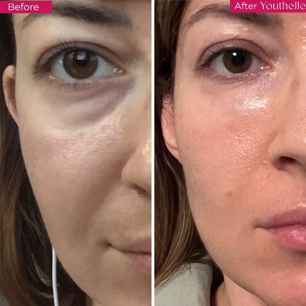 Youthelle™ Moisturizing Essence