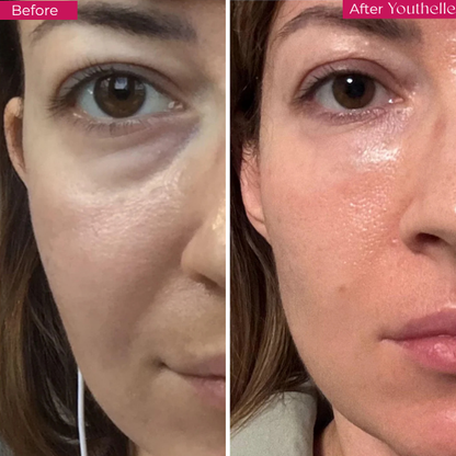 Youthelle™ Moisturizing Essence
