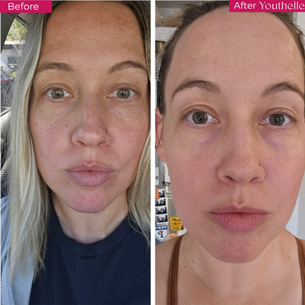 Youthelle™ Moisturizing Essence